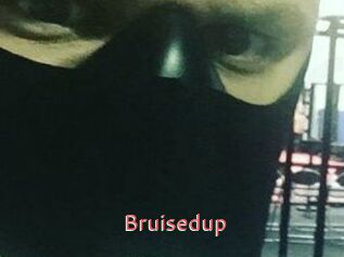 Bruisedup