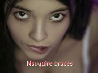 Nauguire_braces
