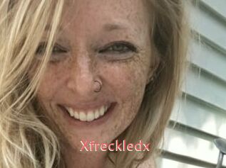 Xfreckledx